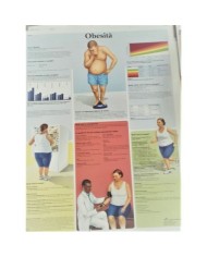 3B Scientific, tavola anatomica,  Obesità (cod, VR4460UU)