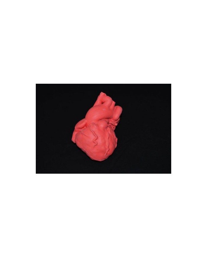 Cuore pediatrico con tetralogia di Fallot - Erler Zimmer G580