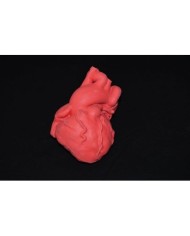 Cuore pediatrico con tetralogia di Fallot - Erler Zimmer G580