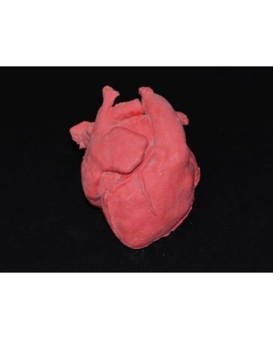 Cuore pediatrico con corretta trasposizione delle grandi arterie e patologia del setto ventricolare (VSD)  - Erler Zimmer G570 Cuore pediatrico con corretta trasposizione delle grandi arterie e patologia del setto ventricolare (VSD)  - Erler Zimmer G570