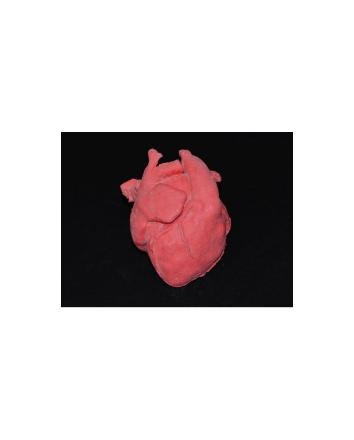 Cuore pediatrico con corretta trasposizione delle grandi arterie e patologia del setto ventricolare (VSD)  - Erler Zimmer G570