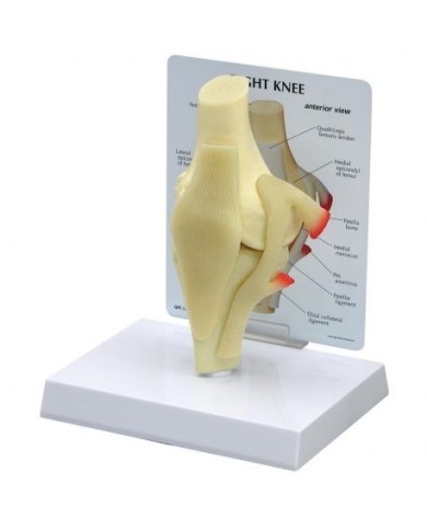 Modello base di articolazione del ginocchio 3B Scientific 1019499