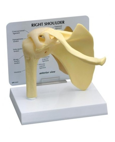 Stadi di osteoartrite dell'articolazione della spalla (4 stadi) 3B Scientific 1019514