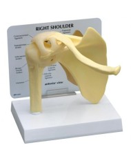 Stadi di osteoartrite dell'articolazione della spalla (4 stadi) 3B Scientific 1019514