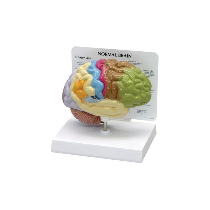 Modello anatomico di mezzo cervello normale 3B Scientific 1019543