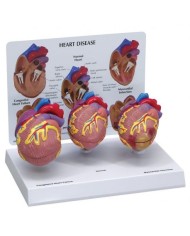 Set didattico, le patologie del cuore, con tre modelli - 3B Scientific 1019530