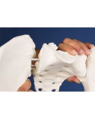 Colonna vertebrale lombare, con bacino e femori per la dimostrazione di cattive posizioni