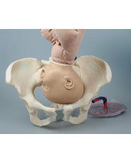 Erler Zimmer, Pelvi femminile con manichino di feto - 4071
