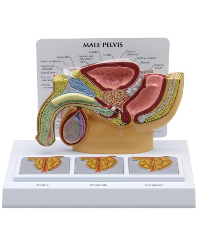 Modello anatomico di Pelvi maschile con prostata 3D in sezione 3B Scientific 1019563