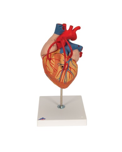 Modello di cuore con bypass, ingrandito 2 volte, in 4 parti, G06 Modello di cuore con bypass, ingrandito 2 volte, in 4 parti, G06