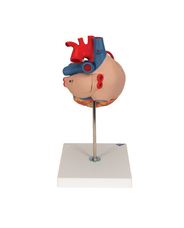 Modello di cuore con bypass, ingrandito 2 volte, in 4 parti, G06