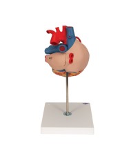 Modello di cuore con bypass, ingrandito 2 volte, in 4 parti, G06