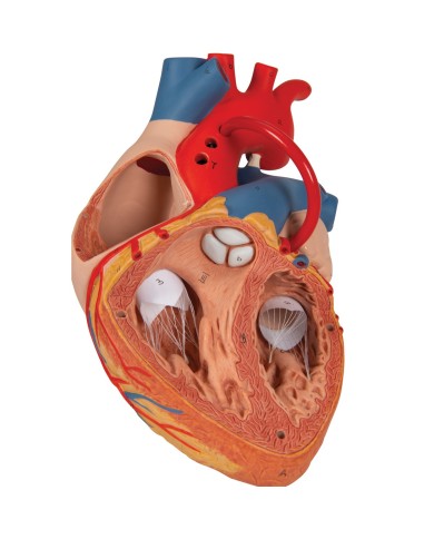 Modello di cuore con bypass, ingrandito 2 volte, in 4 parti, G06 Modello di cuore con bypass, ingrandito 2 volte, in 4 parti, G06
