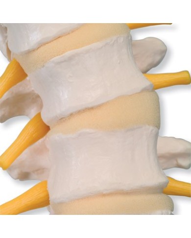 3B Scientific, Colonna vertebrale flessibile con dischi intervertebrali morbidi VB84