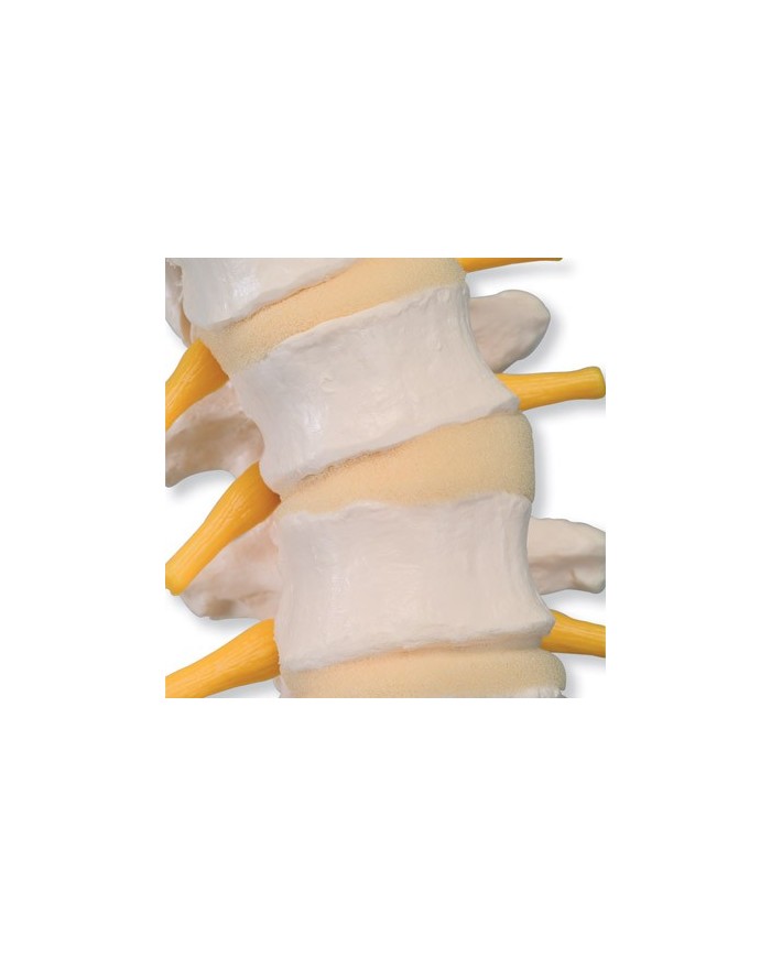 3B Scientific, Colonna vertebrale flessibile con dischi intervertebrali morbidi VB84