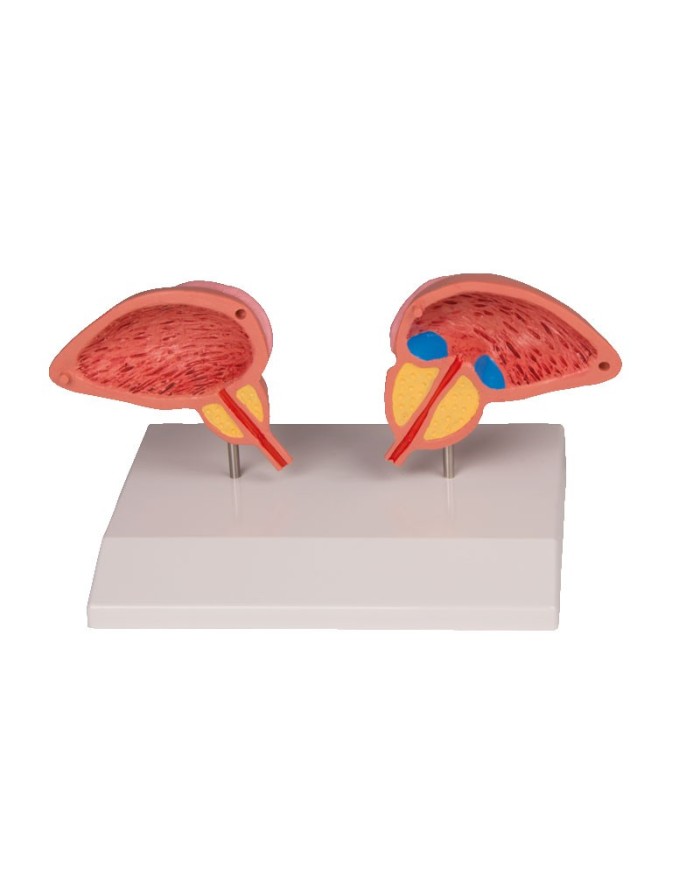 Erler Zimmer, modello anatomico di prostata, scomponibile in 2 parti 1261