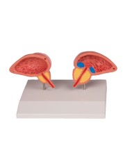 Erler Zimmer, modello anatomico di prostata, scomponibile in 2 parti 1261