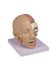 Testa scomponibile in 4 parti, Erler Zimmer C250