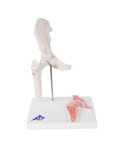 3B Scientific, modello di mini articolazione dell'anca A84/1 con sezione trasversale