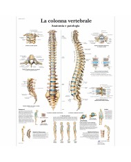 3B Scientific, tavola anatomica, La colonna vertebrale, anatomia e patologia (cod, VR4152UU)