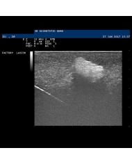 Modello di mammella con tumori SONOtrain P125