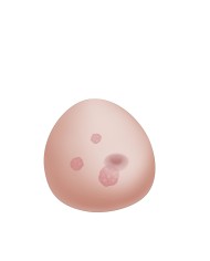 Modello di mammella con tumori SONOtrain P125