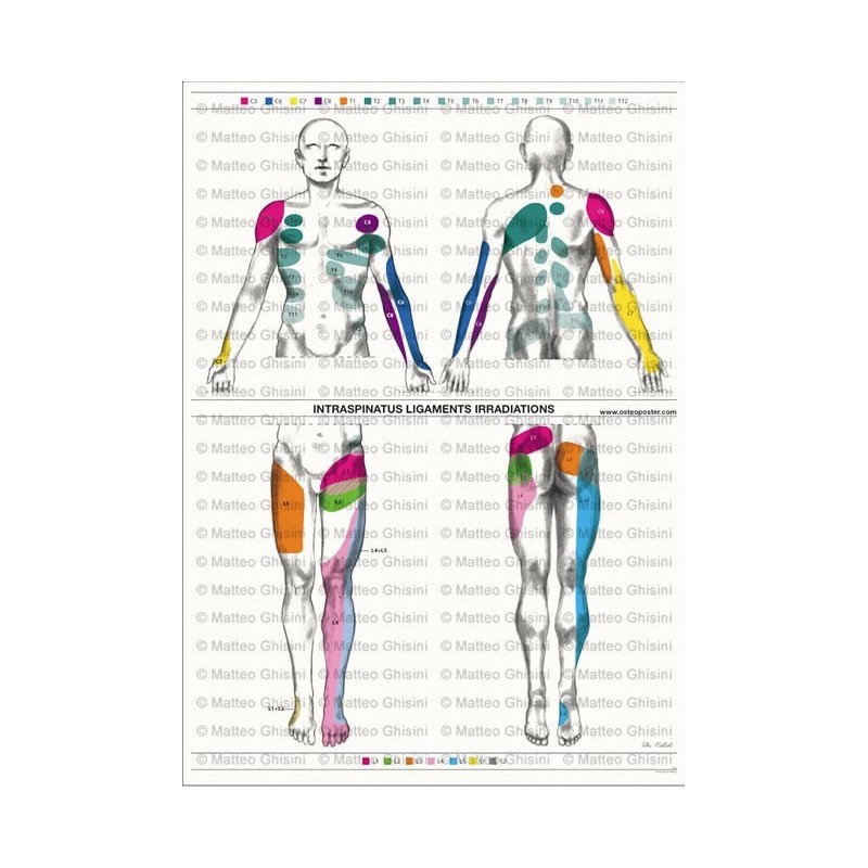Osteoposter - Irradiazione Legamenti Interspinosi Verticale