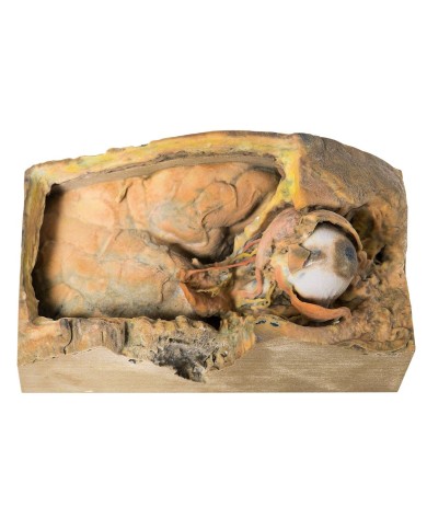 Orbita Laterale - Erler Zimmer 3D anatomy Series