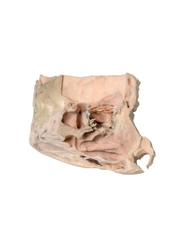 Orbita Mediale Erler Zimmer 3D anatomy Series