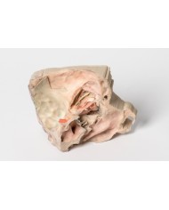 Orbita Mediale Erler Zimmer 3D anatomy Series