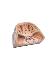 Orbita Superiore Erler Zimmer 3D anatomy Series