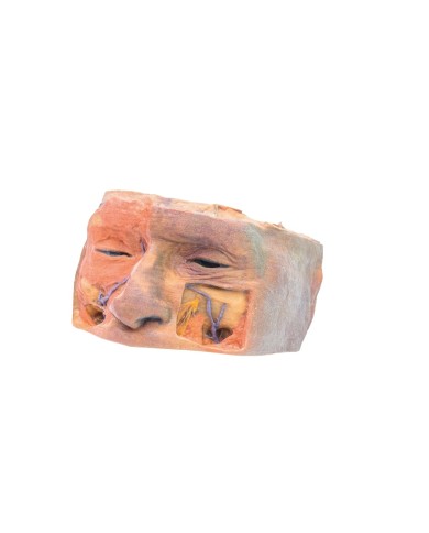 Orbita Superiore Erler Zimmer 3D anatomy Series