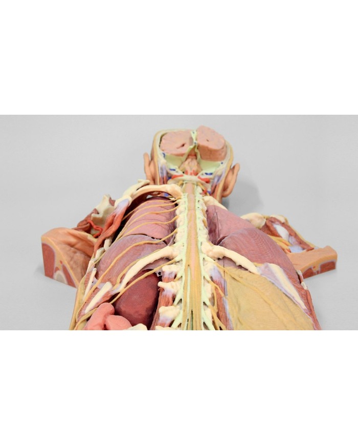 Dissezione del sistema nervoso Vista posteriore Erler Zimmer 3D anatomy