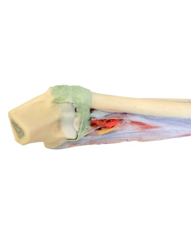 Dissezione profonda dellavambraccio e della mano Erler Zimmer 3D anatomy