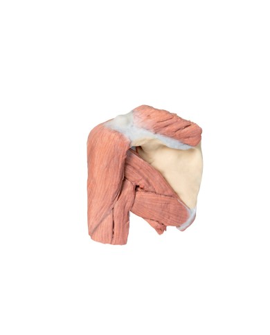 Dissezione della spalla sinistra - Muscoli superficiali e arteria ascellare e brachiale - Erler Zimmer 3D anatomy Series