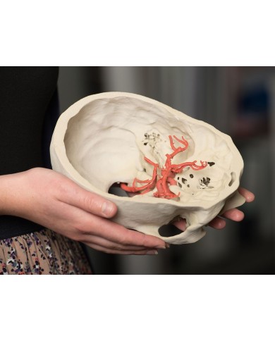 Poligono di Willis (circolo di Willis) - Erler Zimmer 3D anatomy Series