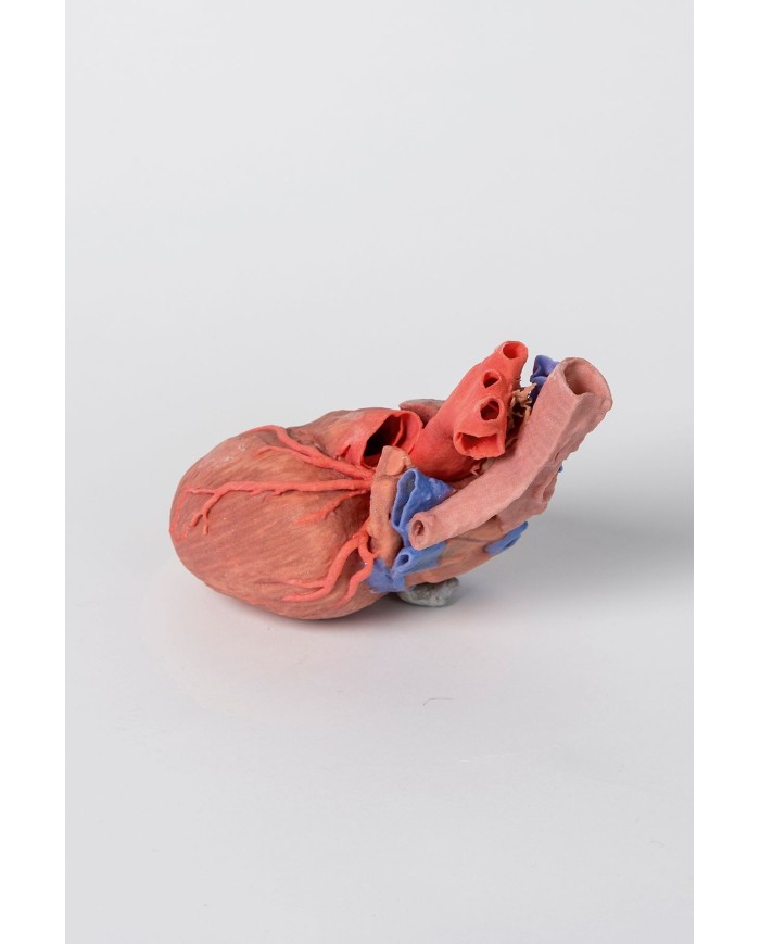 Cuore e trachea distale carena e bronchi primari Erler Zimmer 3D anatomy