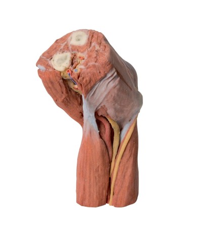 Fossa cubitale muscoli nervi principali e arteria brachiale Erler Zimme Fossa cubitale muscoli nervi principali e arteria brachiale Erler Zimme