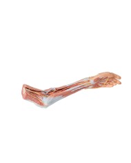 Dissezione dell'arto superiore, gomito, avambraccio e mano - Erler Zimmer 3D anatomy Series