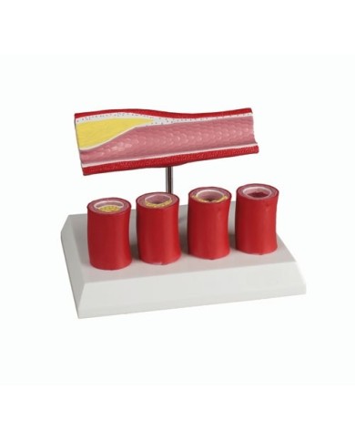 Erler Zimmer, modello anatomico di arteria con 4 sezioni arteriose G240 Erler Zimmer, modello anatomico di arteria con 4 sezioni arteriose G240