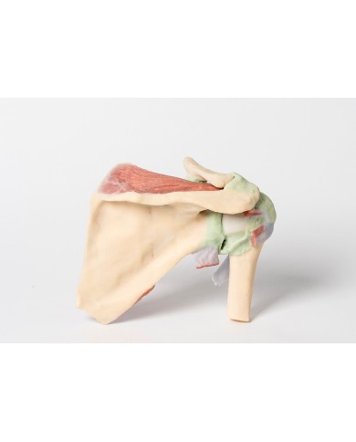 Dissezione profonda di un cingolo scapolare destro preservando una scapola