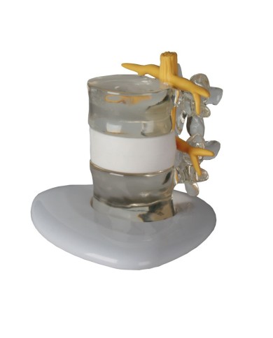 Erler Zimmer simulatore di disco intervertebrale erniato 4400