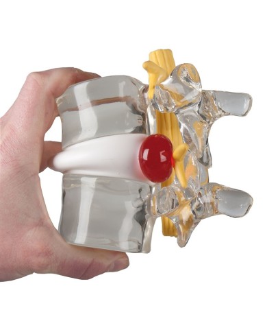 Erler Zimmer simulatore di disco intervertebrale erniato 4400