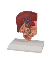Modello di calcoli biliari EZ K226