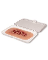 Moulage di ulcera venosa della gamba piccola fase di essudazione PW002A