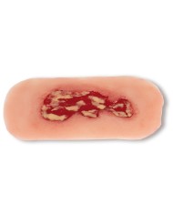 Moulage di ulcera venosa della gamba piccola fase di essudazione PW002A