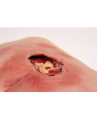 Moulage di ulcera da decubito sacrale pulita PW001B