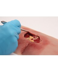Moulage di ulcera da decubito sacrale pulita PW001B