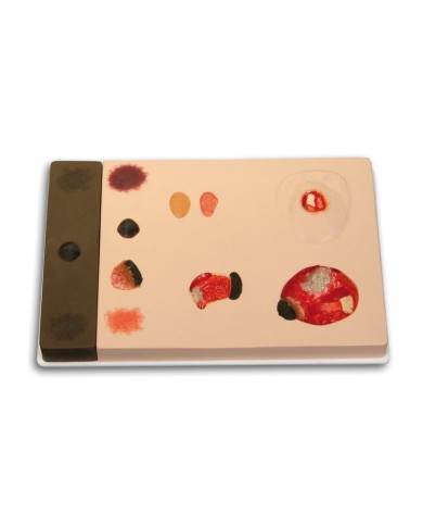 Stadi diversi di ulcera da pressione Erler Zimmer R10167