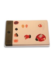 Stadi diversi di ulcera da pressione Erler Zimmer R10167